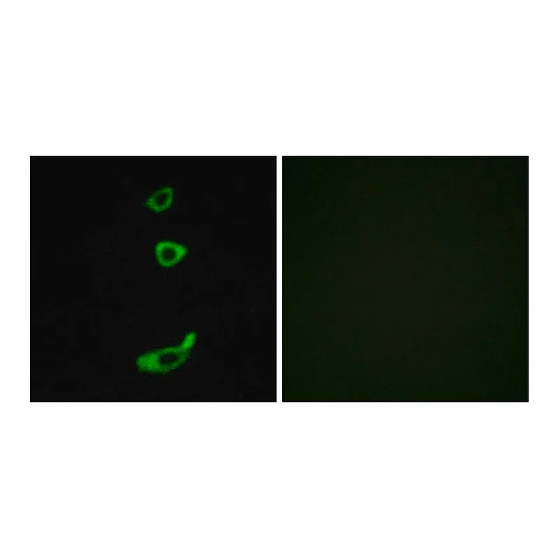 Merck Anti-CRHR1 antibody produced in rabbit