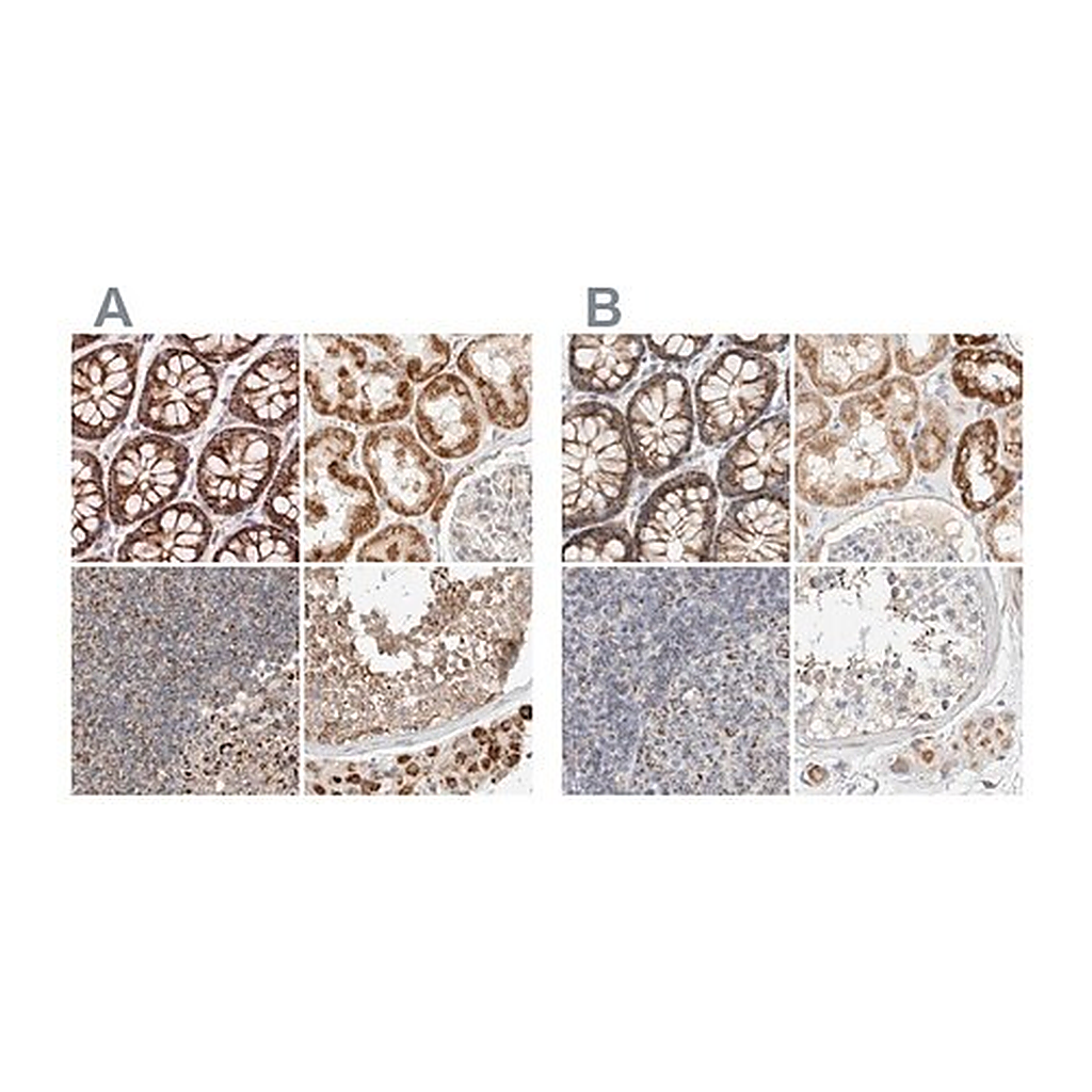 Merck Anti-MRM3 antibody produced in rabbit