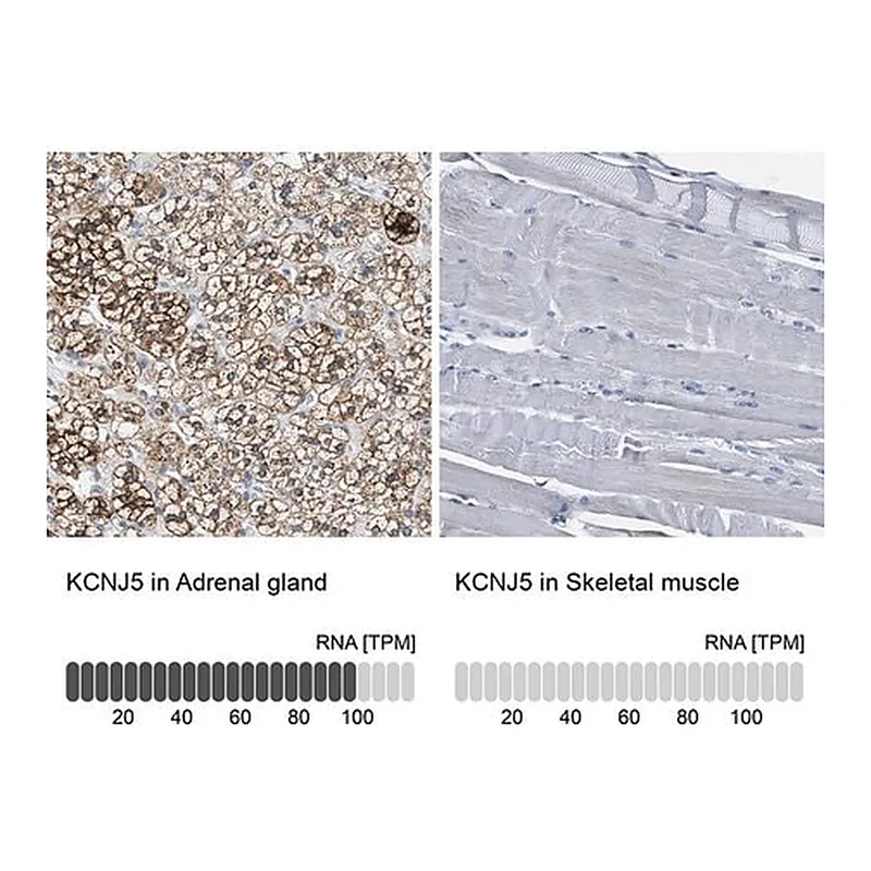 Merck Anti-KCNJ5 antibody produced in rabbit