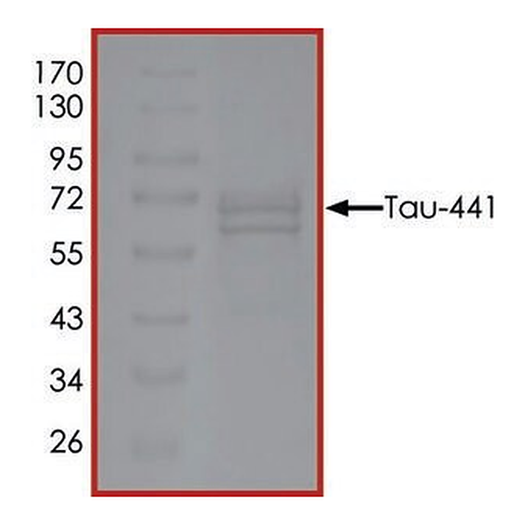 Merck TAU-441, GSK3BETA-PHOSPHORYLATED
