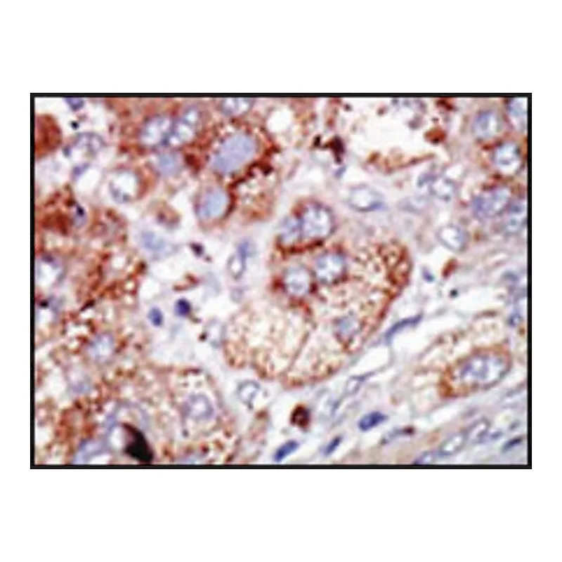 Merck Anti-PFKFB4 (center) antibody produced in rabbit