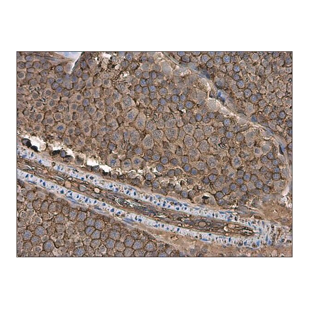 Merck Anti-GNB1 antibody produced in rabbit