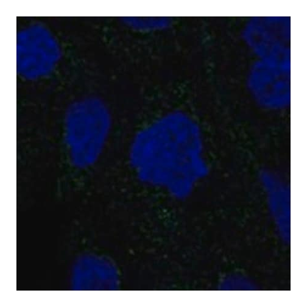 Merck Anti-RSAD1 antibody produced in rabbit