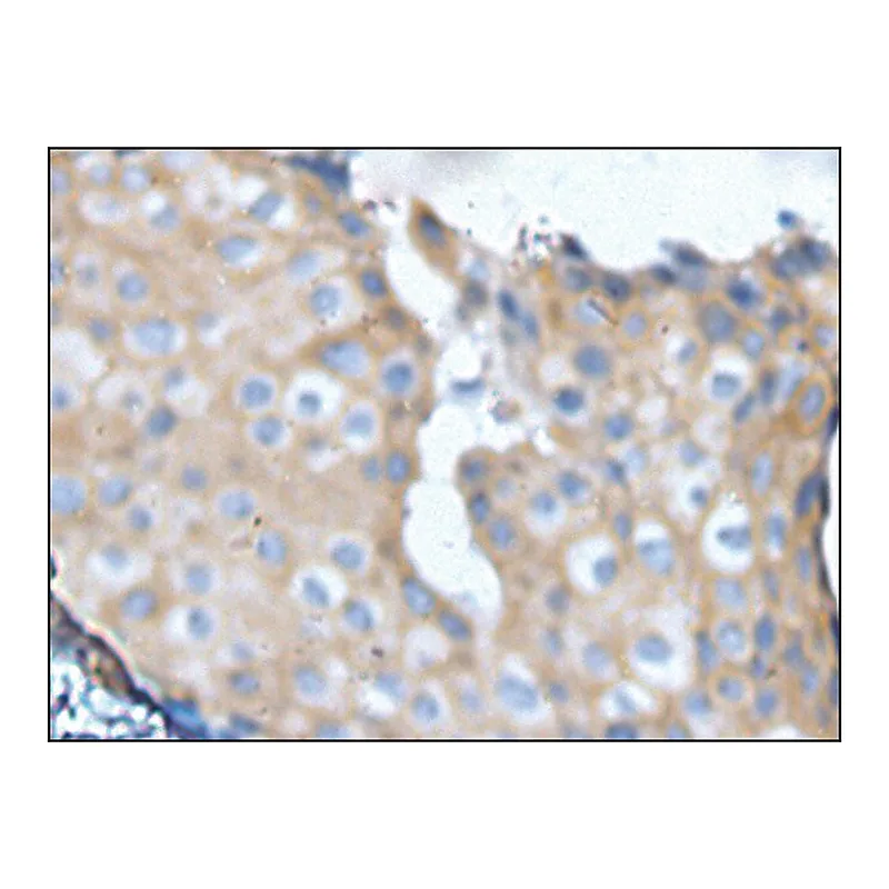 Merck Anti-NF1