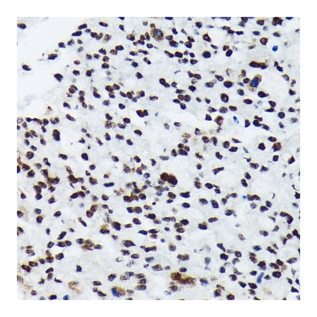 Merck Anti-Phospho-p70 S6 Kinase 1-T421/S424 antibody produced in rabbit