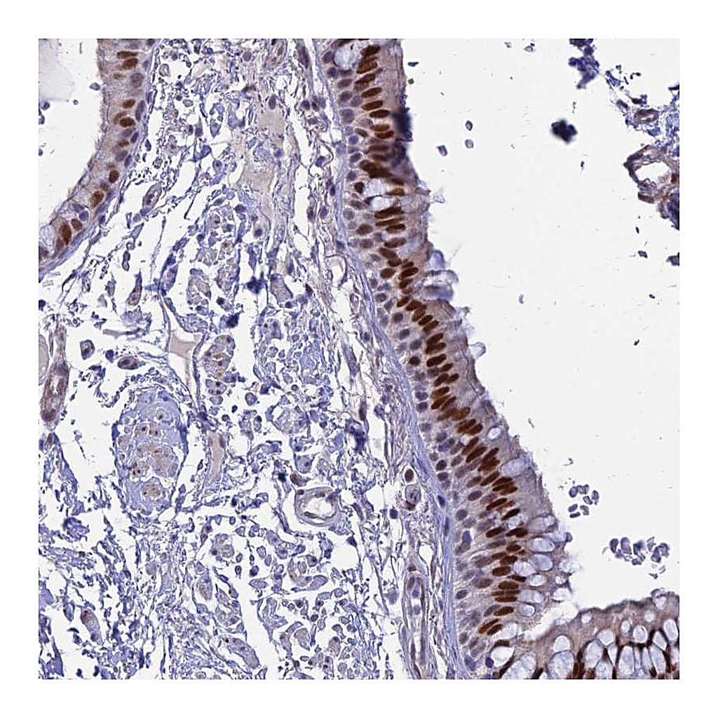 Atlas Antibodies Anti-CLK4 Antibody
