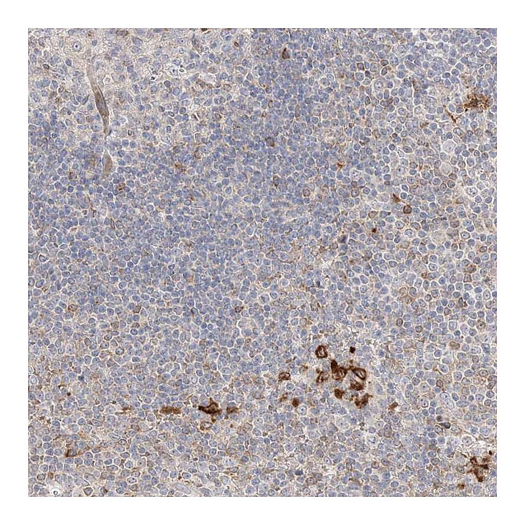 Atlas Antibodies Anti-CLNK Antibody