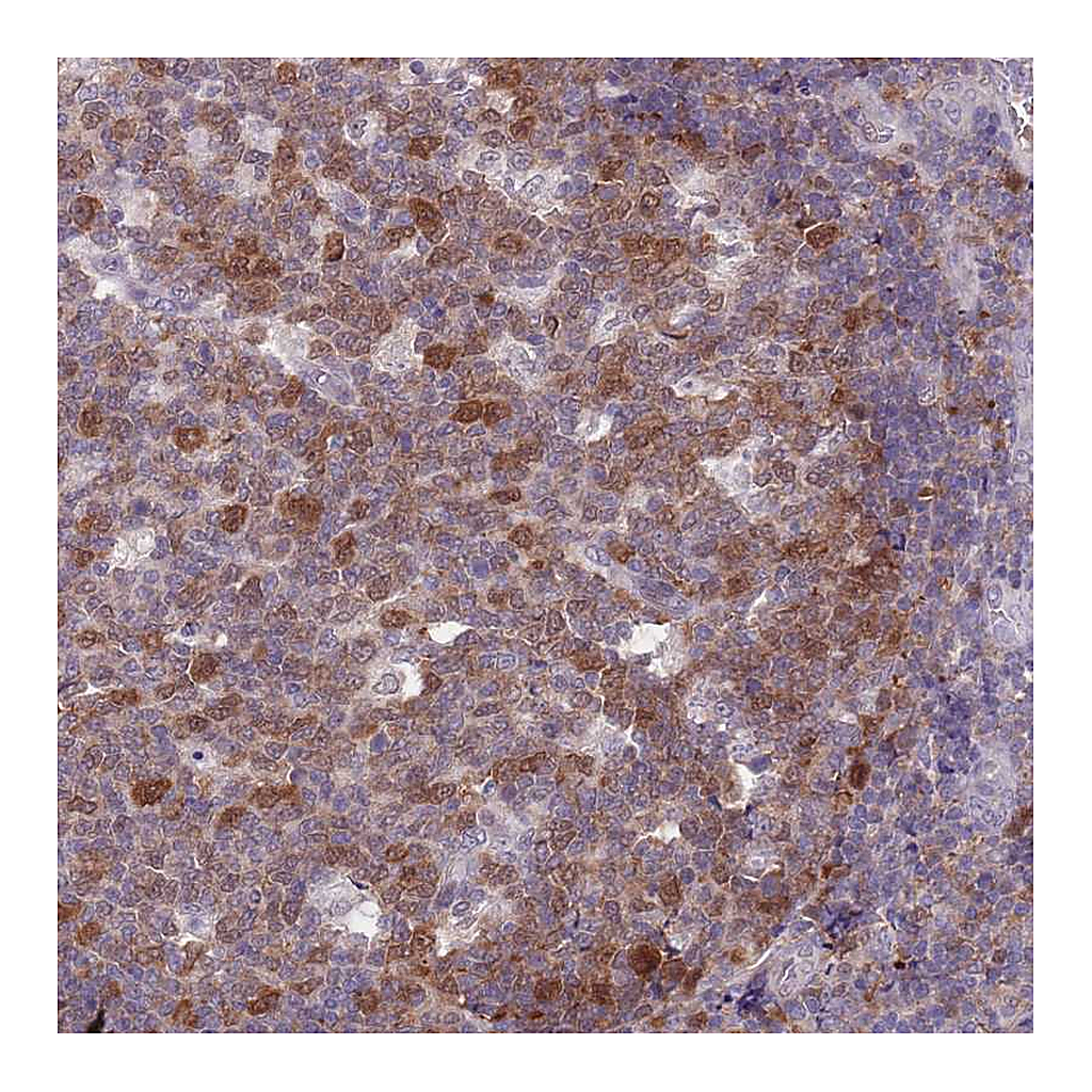 Atlas Antibodies Anti-CLNS1A Antibody