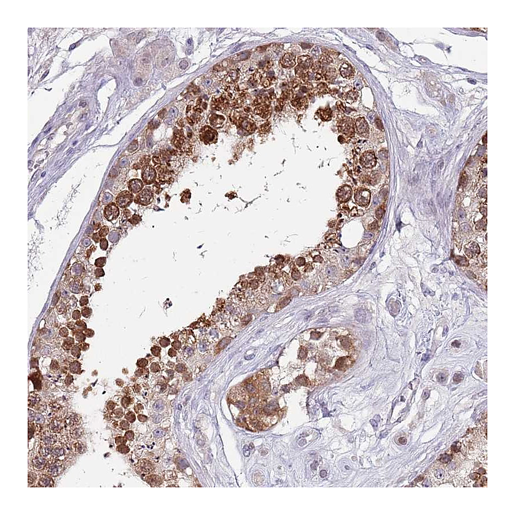 Atlas Antibodies Anti-CLNS1A Antibody