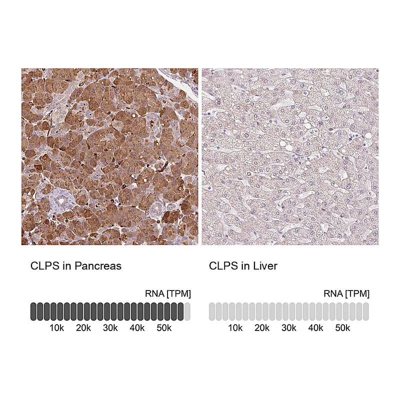 Atlas Antibodies Anti-CLPS Antibody