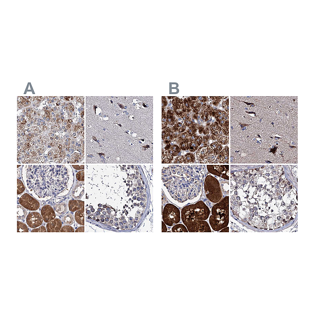 Atlas Antibodies Anti-CLPB Antibody