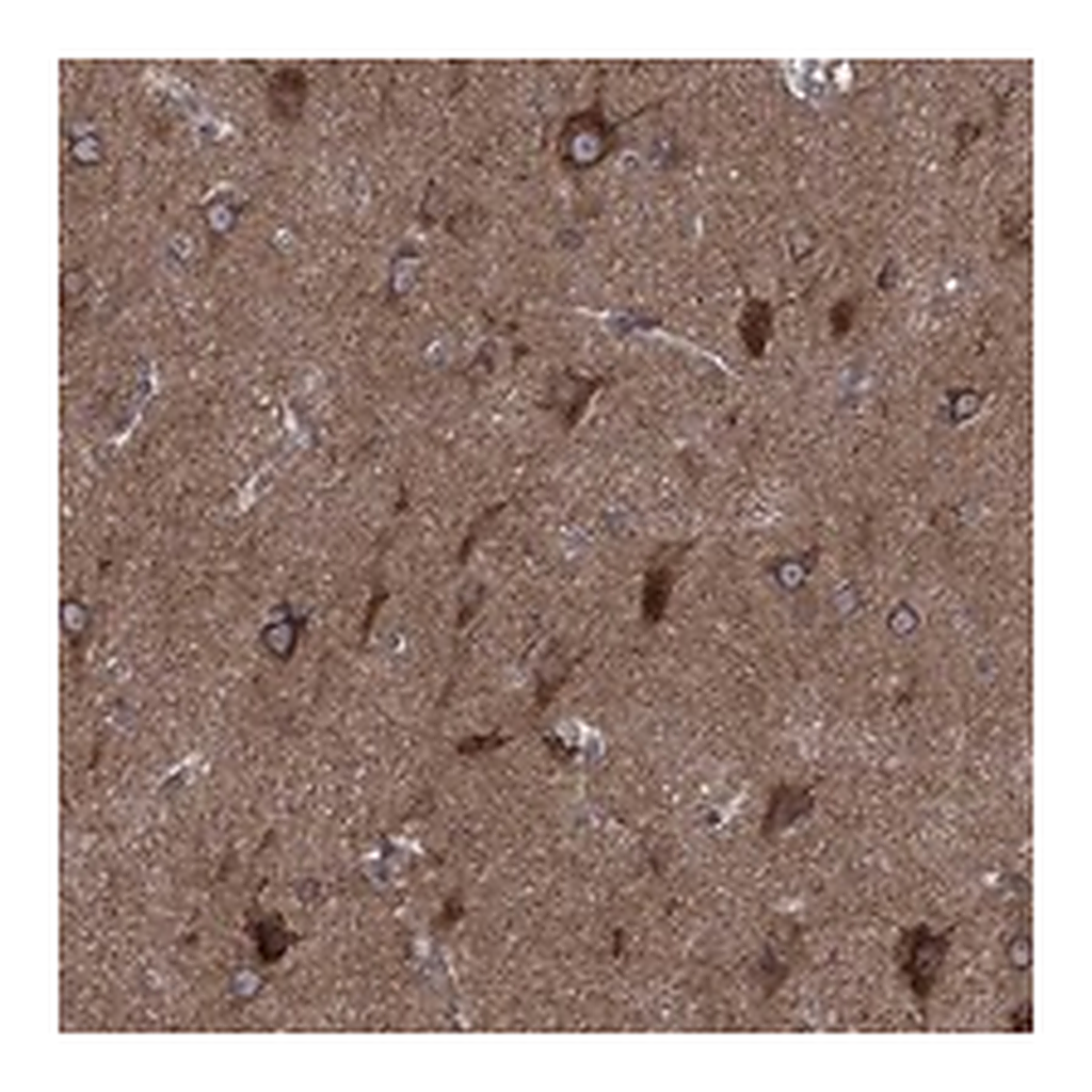 Atlas Antibodies Anti-CLPTM1 Antibody