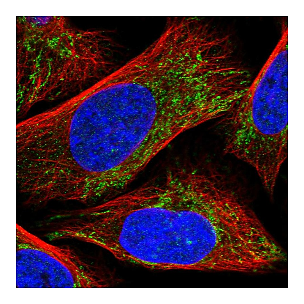 Atlas Antibodies Anti-CLPX Antibody