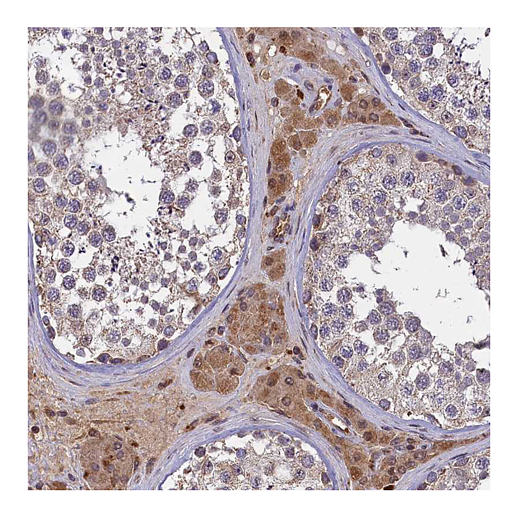 Atlas Antibodies Anti-CLRN2 Antibody