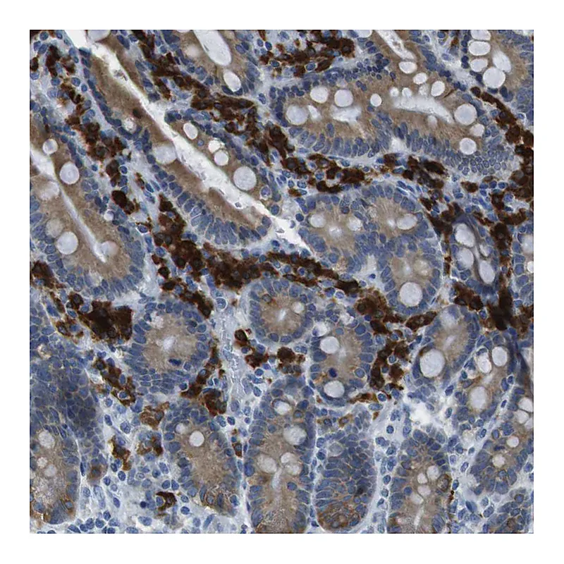 Atlas Antibodies Anti-CLPTM1L Antibody