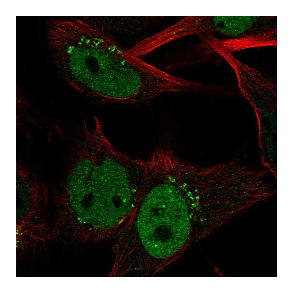 Atlas Antibodies Anti-CLSPN Antibody