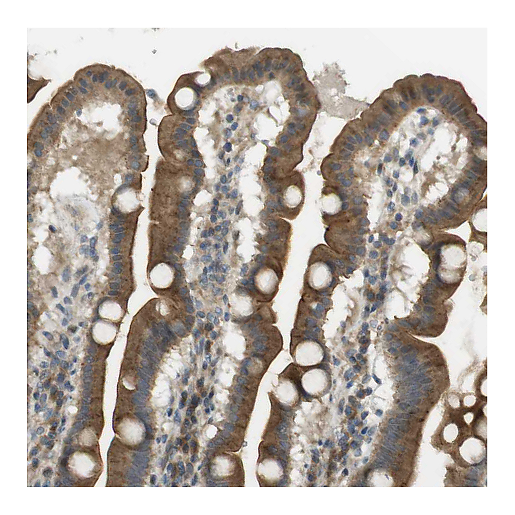 Atlas Antibodies Anti-CLRN3 Antibody