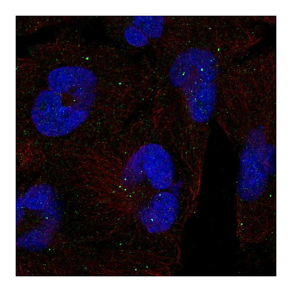 Atlas Antibodies Anti-CLTCL1 Antibody