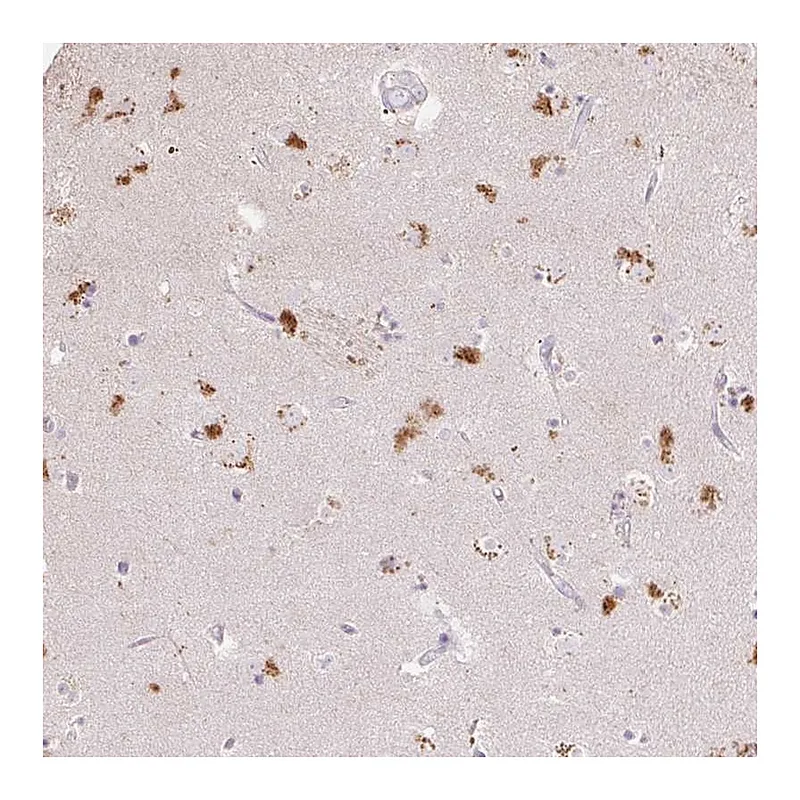 Atlas Antibodies Anti-CLVS1 Antibody