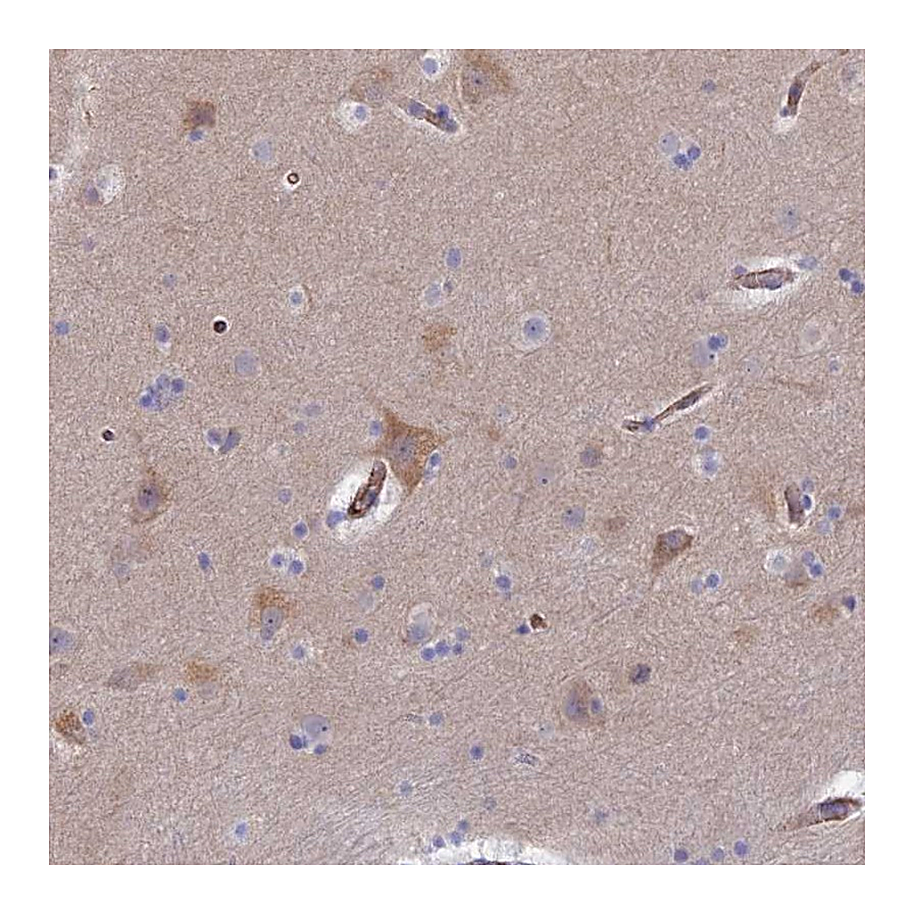 Atlas Antibodies Anti-CLVS2 Antibody