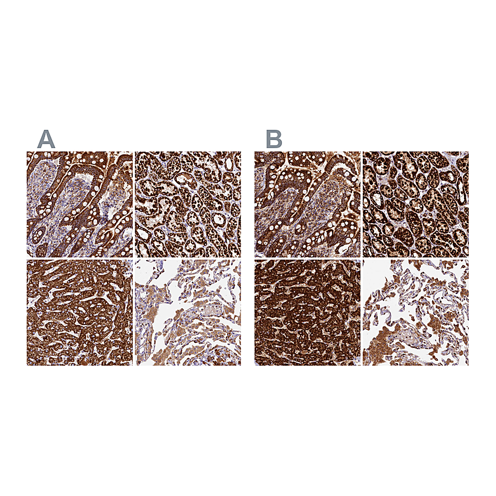 Atlas Antibodies Anti-CLYBL Antibody