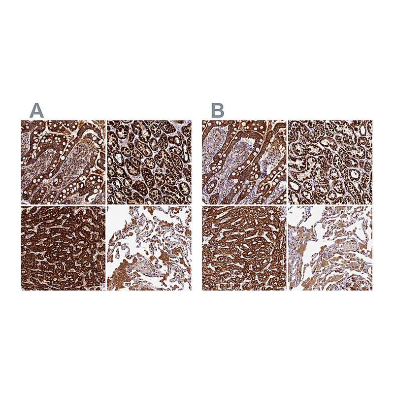 Atlas Antibodies Anti-CLYBL Antibody