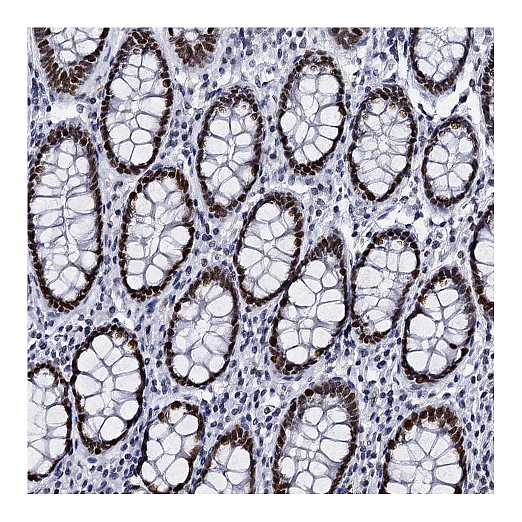 Atlas Antibodies Anti-CMAS Antibody