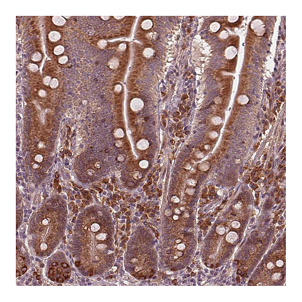 Atlas Antibodies Anti-CMIP Antibody