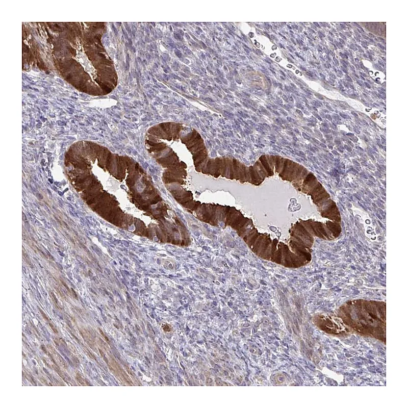 Atlas Antibodies Anti-CMPK1 Antibody