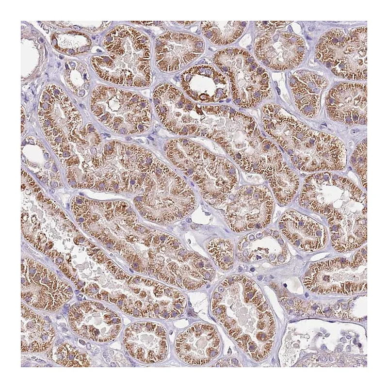 Atlas Antibodies Anti-CMKLR1 Antibody
