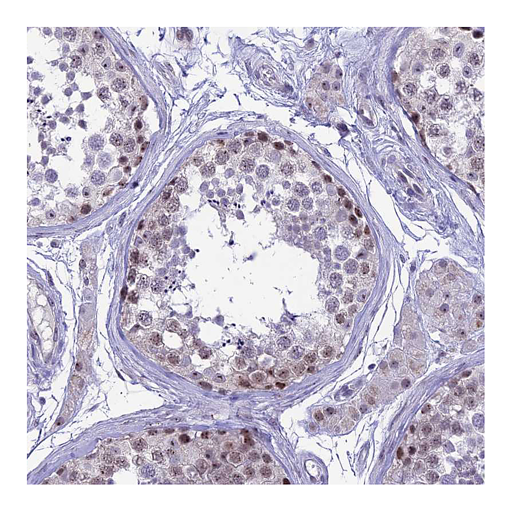 Atlas Antibodies Anti-CMSS1 Antibody