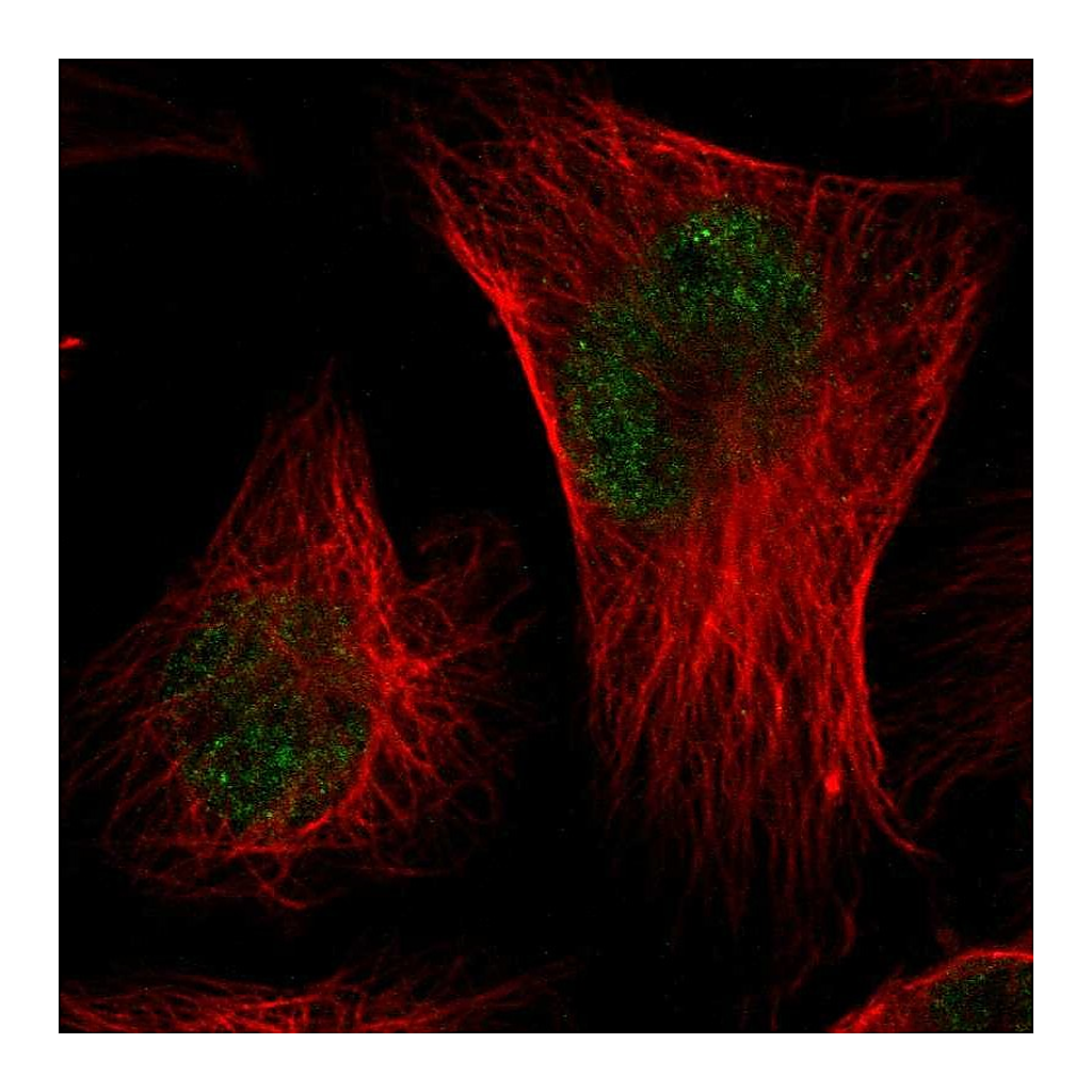 Atlas Antibodies Anti-CMTM3 Antibody