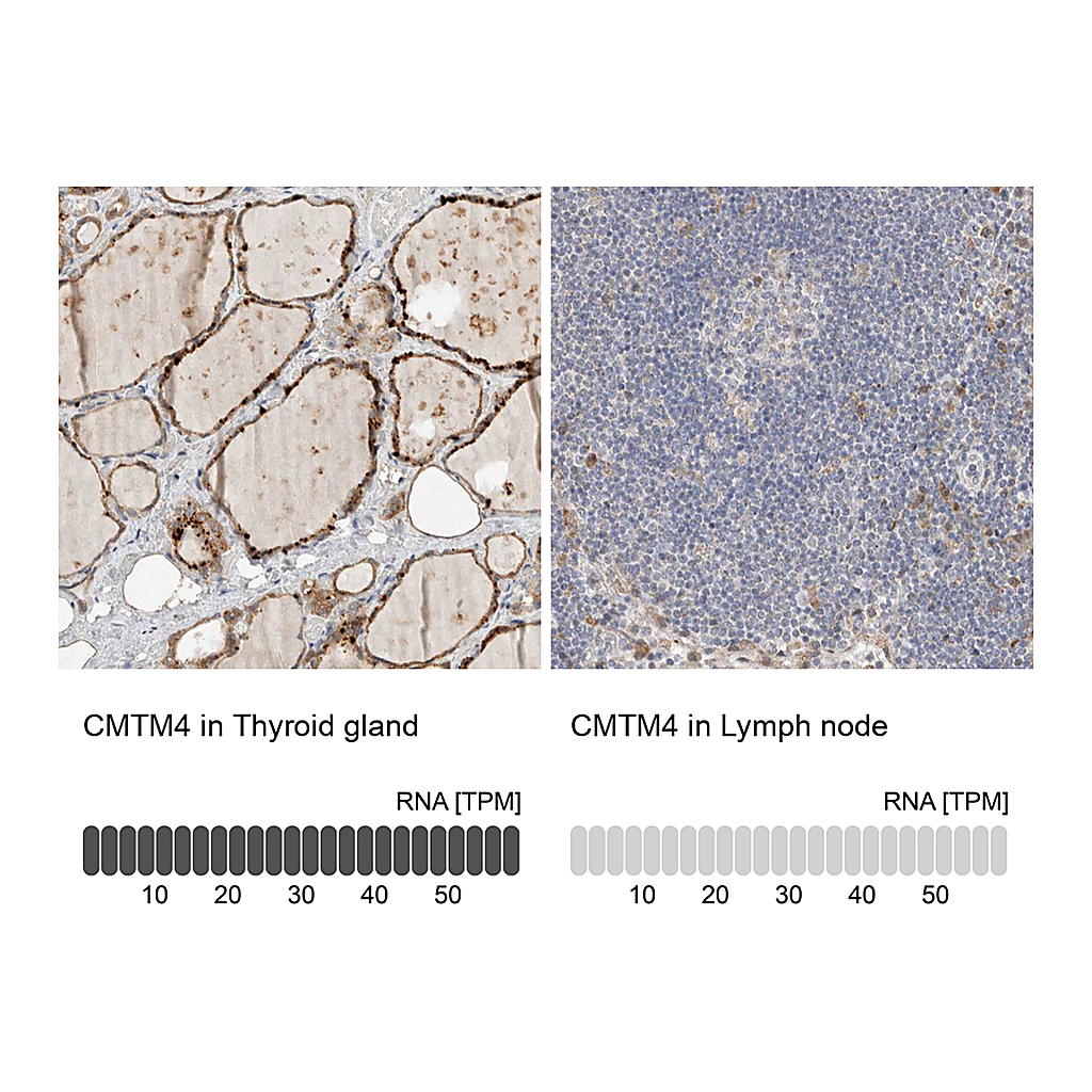 Atlas Antibodies Anti-CMTM4 Antibody