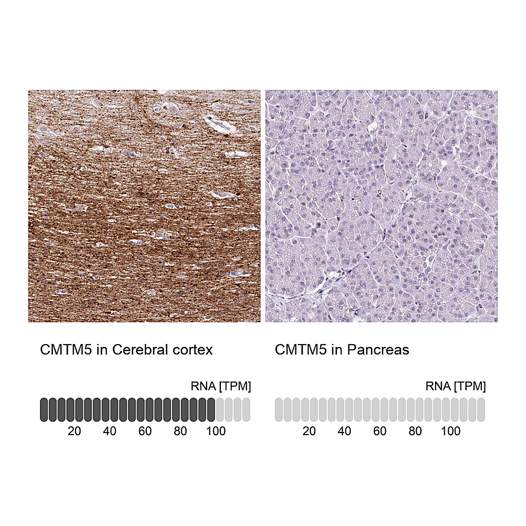 Atlas Antibodies Anti-CMTM5 Antibody