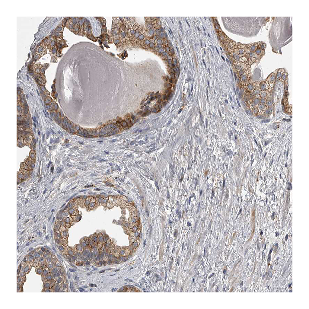 Atlas Antibodies Anti-CMTM6 Antibody