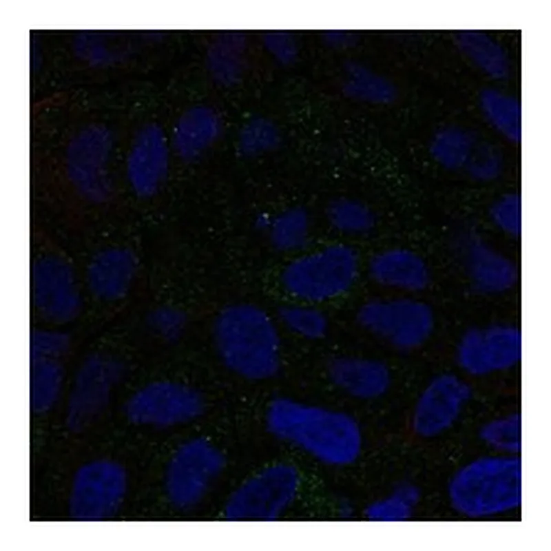 Atlas Antibodies Anti-CMTM6 Antibody