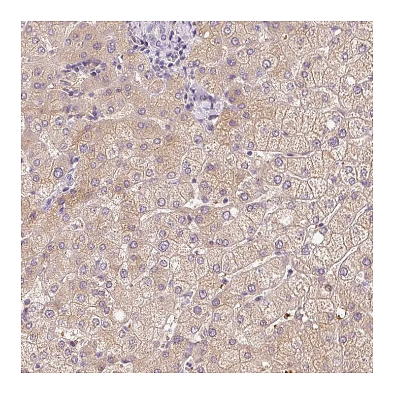 Atlas Antibodies Anti-CMTM8 Antibody