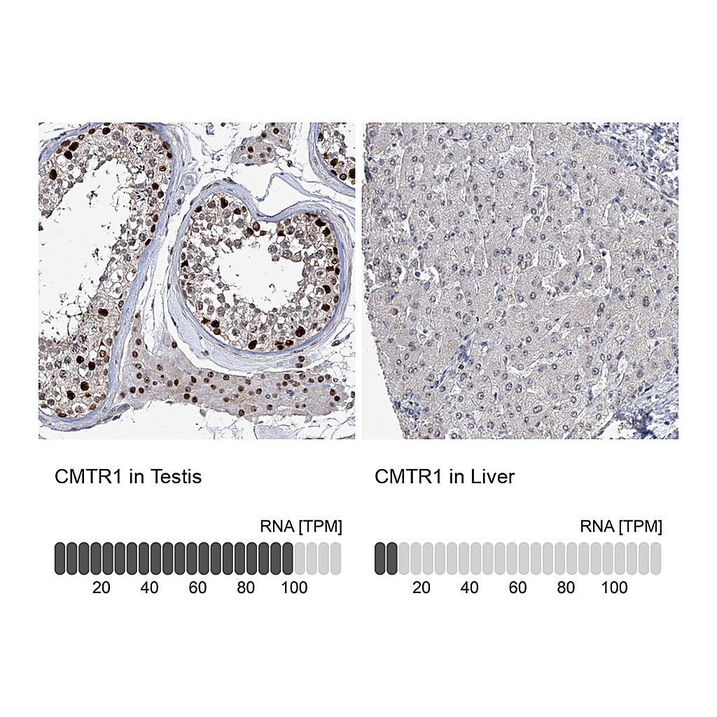 Atlas Antibodies Anti-CMTR1 Antibody