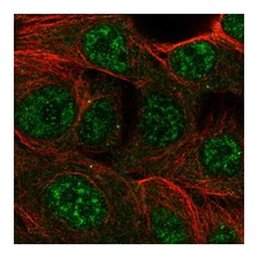 Atlas Antibodies Anti-CMYA5 Antibody