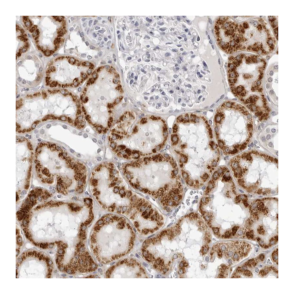 Atlas Antibodies Anti-CNBD1 Antibody