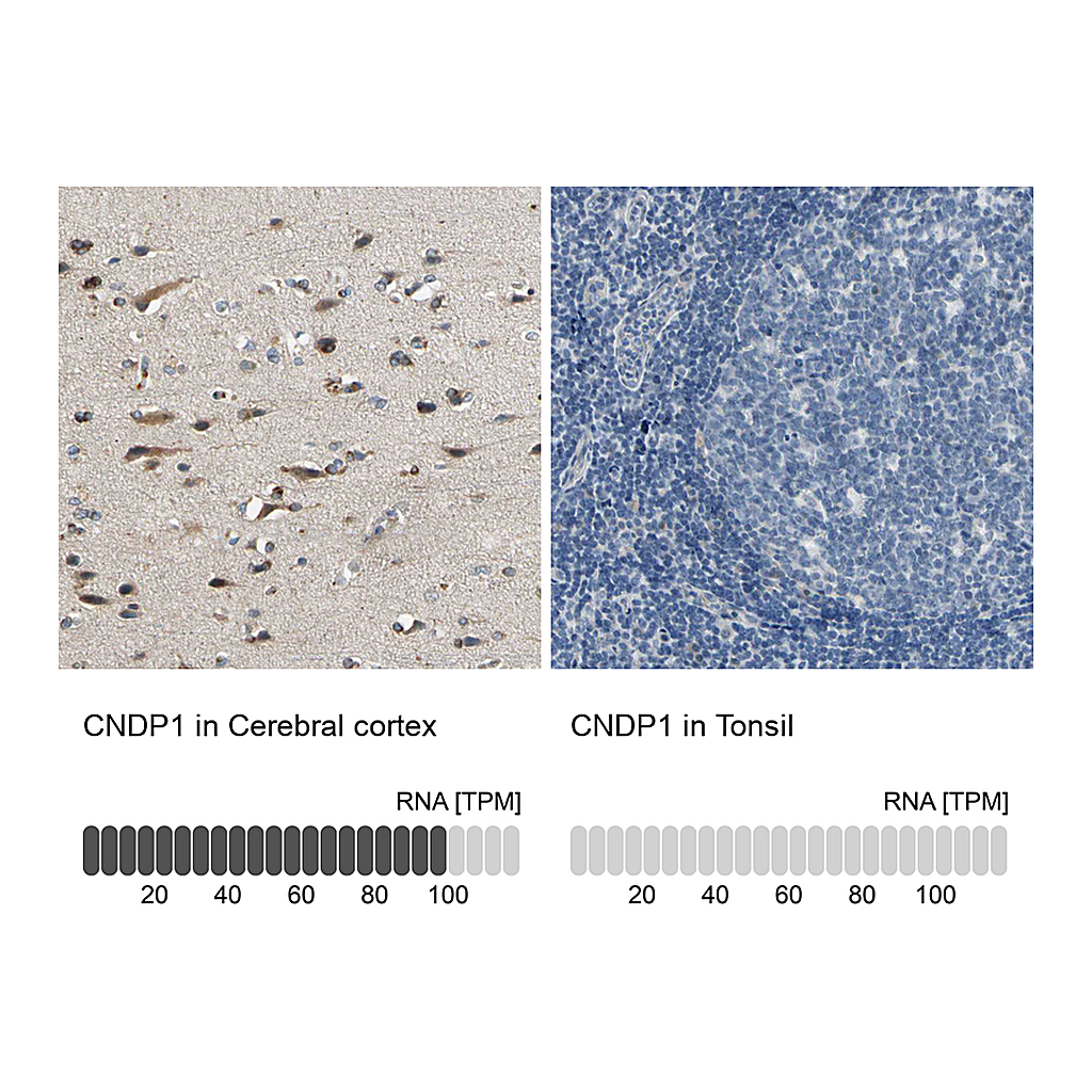 Atlas Antibodies Anti-CNDP1 Antibody