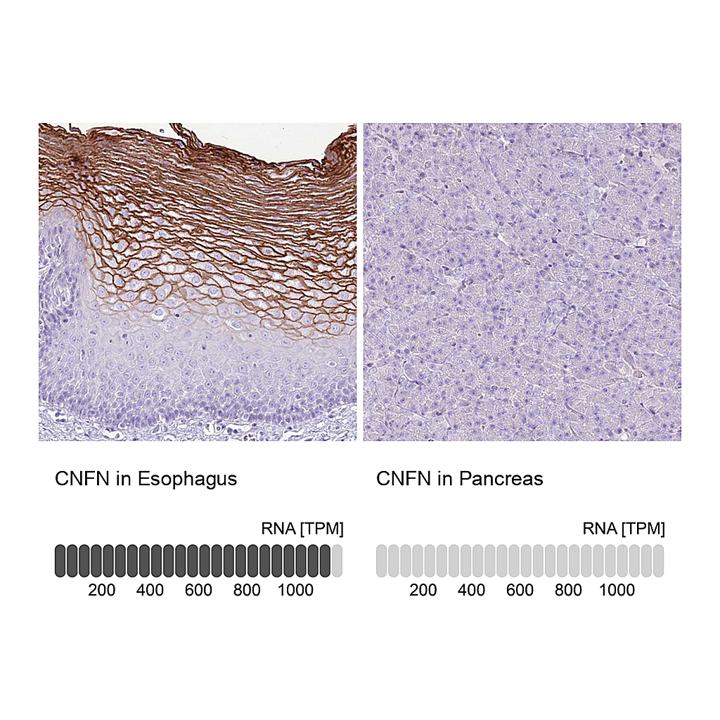 Atlas Antibodies Anti-CNFN Antibody