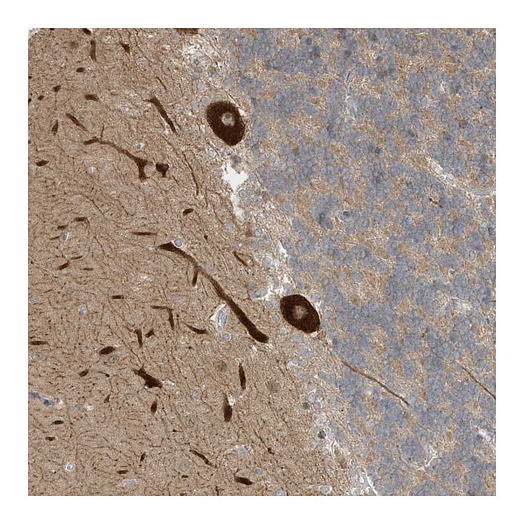 Atlas Antibodies Anti-CNKSR1 Antibody
