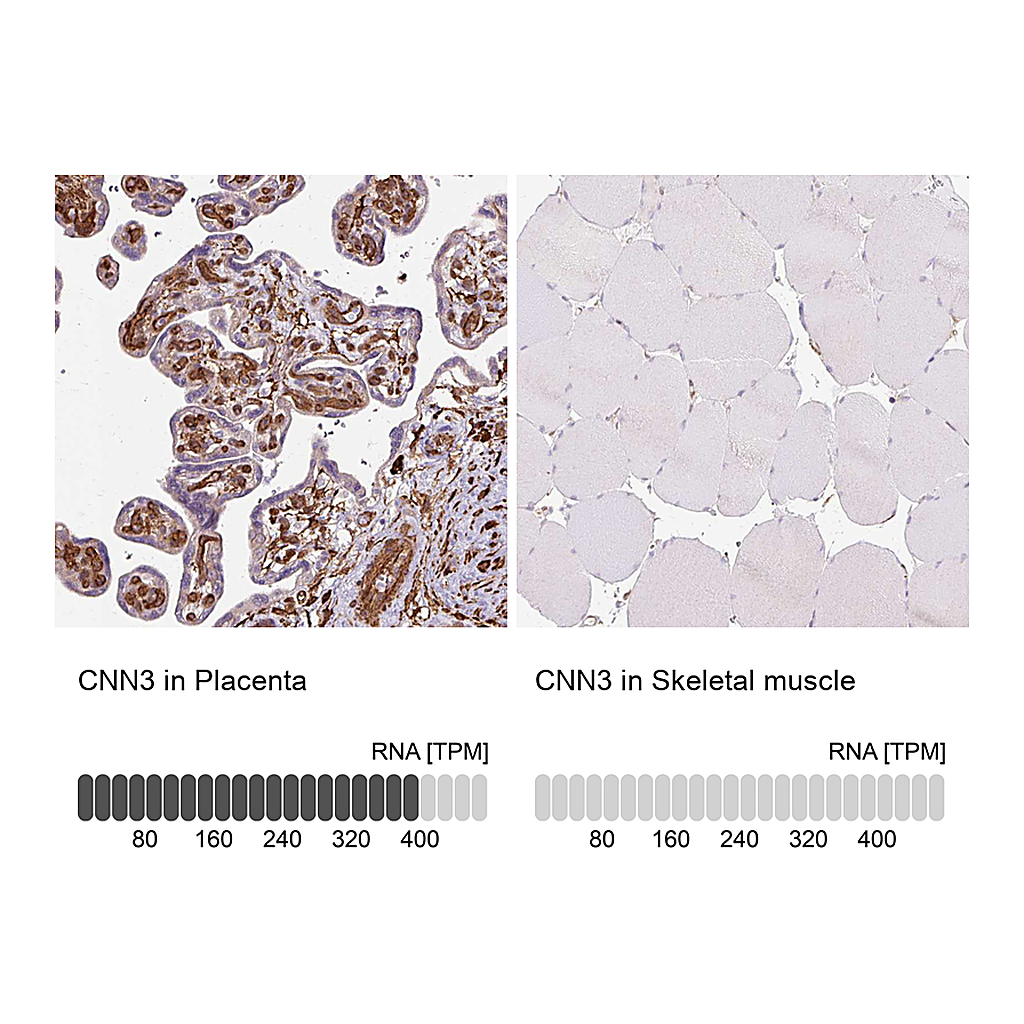 Atlas Antibodies Anti-CNN3 Antibody