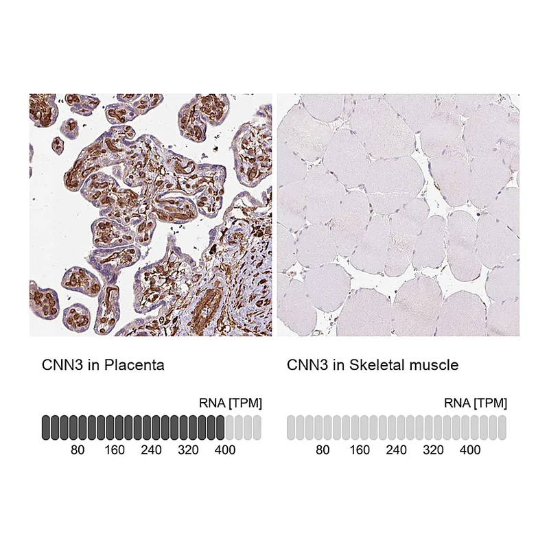 Atlas Antibodies Anti-CNN3 Antibody