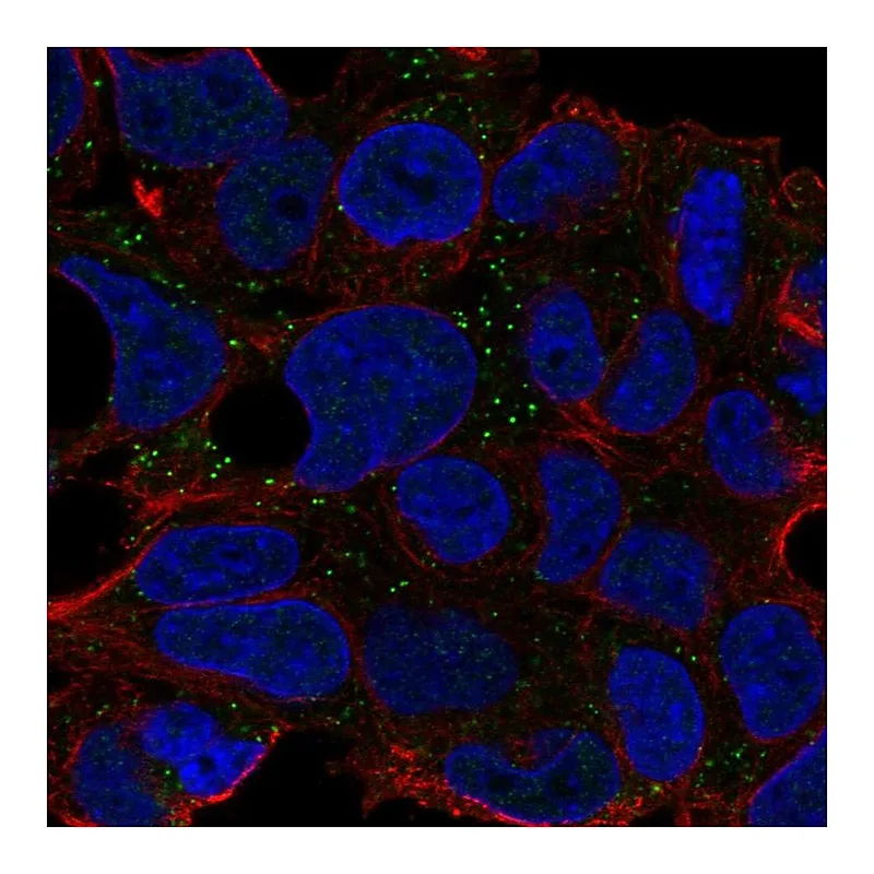 Atlas Antibodies Anti-CNNM2 Antibody