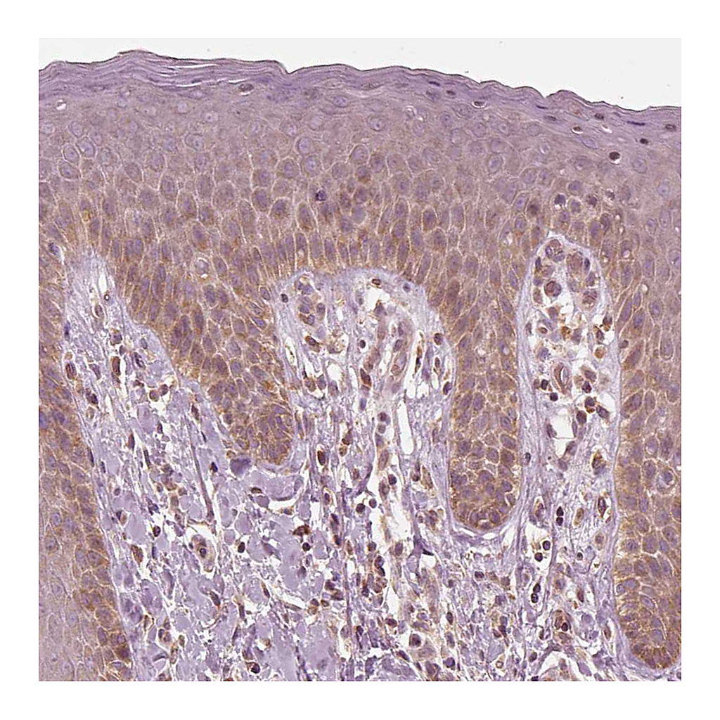 Atlas Antibodies Anti-CNOT2 Antibody