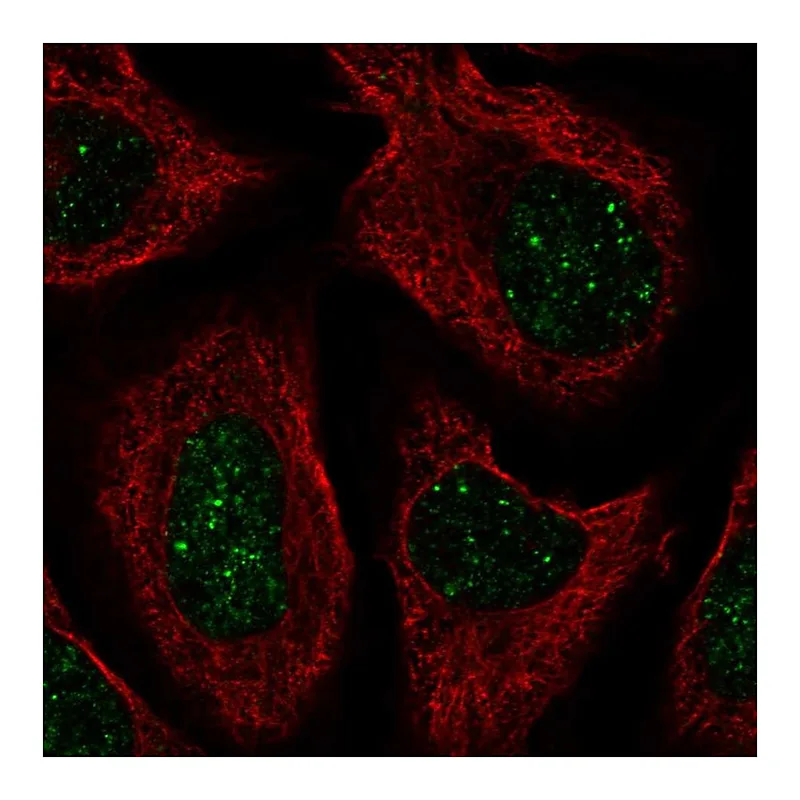 Atlas Antibodies Anti-CNOT7 Antibody