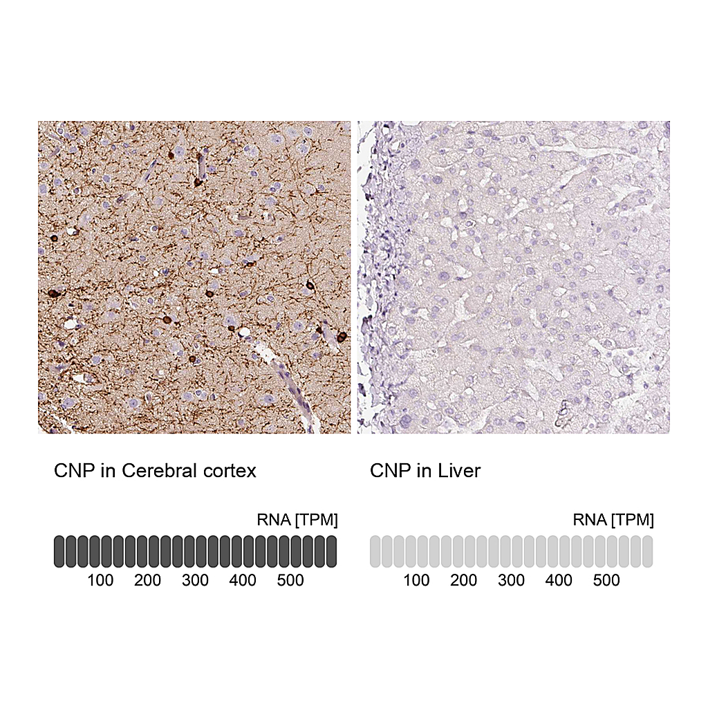 Atlas Antibodies Anti-CNP Antibody