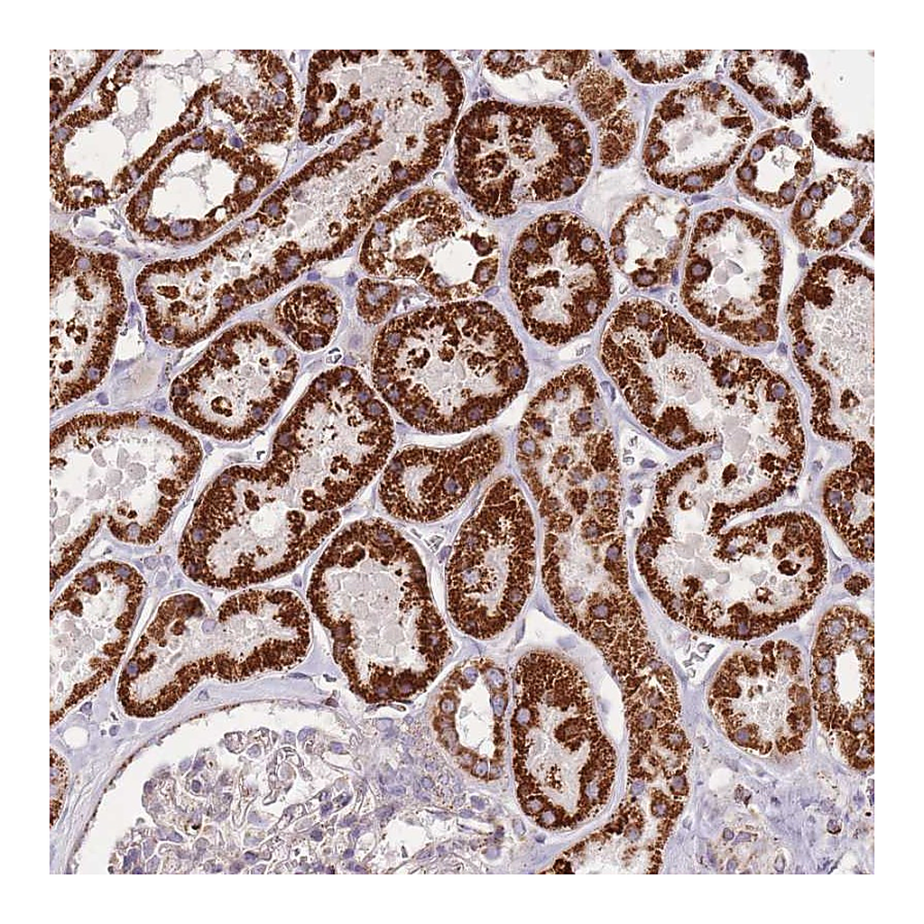 Atlas Antibodies Anti-CNOT8 Antibody